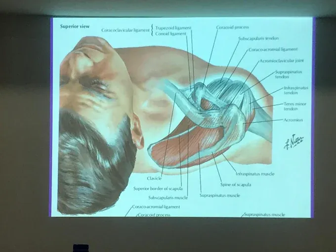 Lecture slide on shoulder anatomy